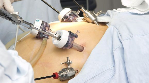 La chirurgia bariatrica potrebbe avere effetti negativi sulla salute orale