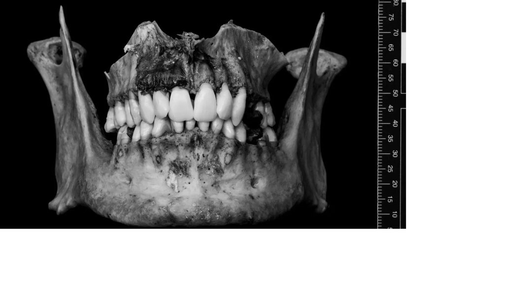Mô hình 3D kỹ thuật số mới cho giáo dục nha khoa pháp y