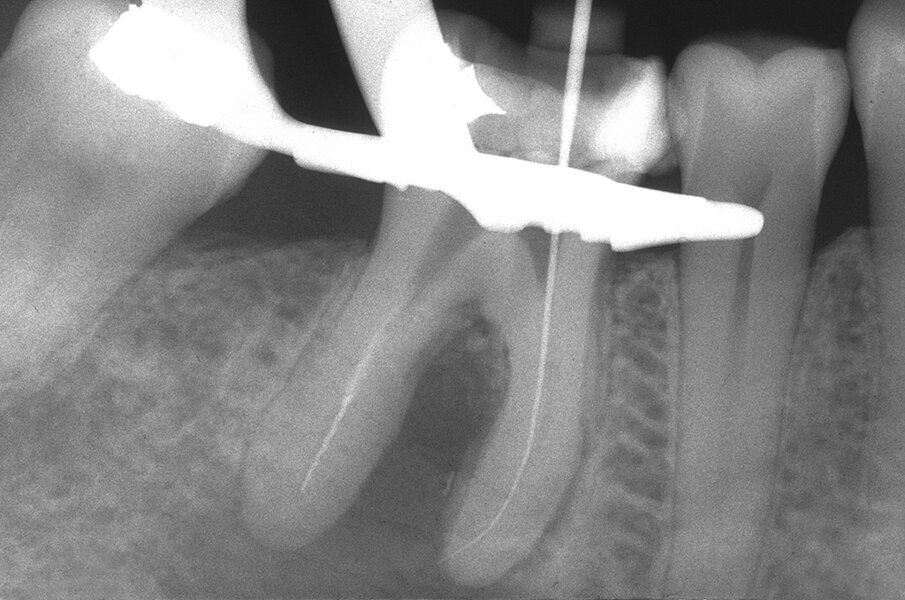 Fig. 3d