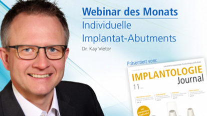 Webinar zu individuellen Implantatabutments mit Dr. Kay Vietor