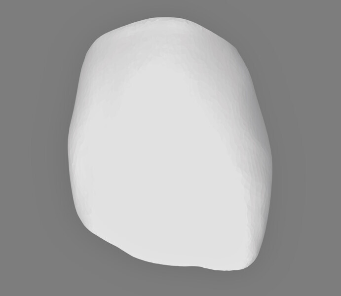 Fig. 1: Design for crown for tooth #11, facial view. (All images: Dr Les Kalman)