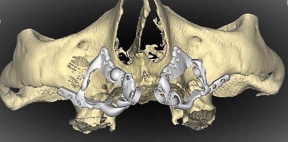 Fig. 8
