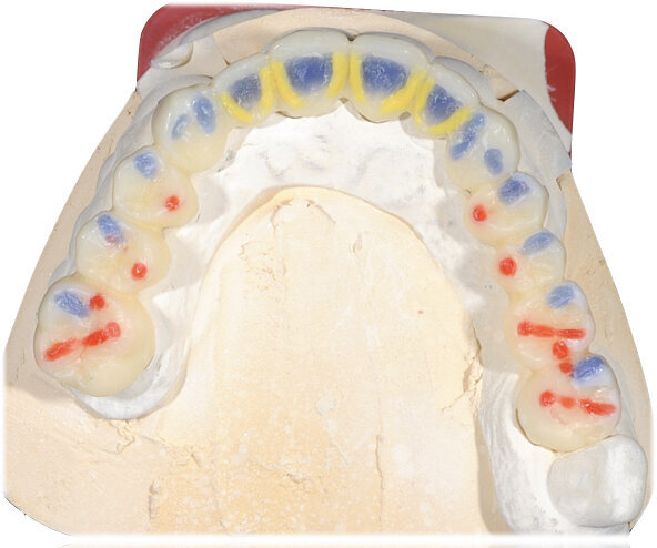 Fig. 34