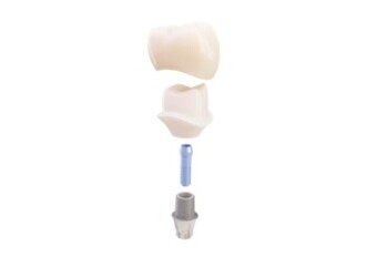TitaniumBase EV