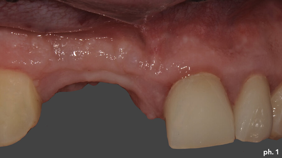 Fig. 1