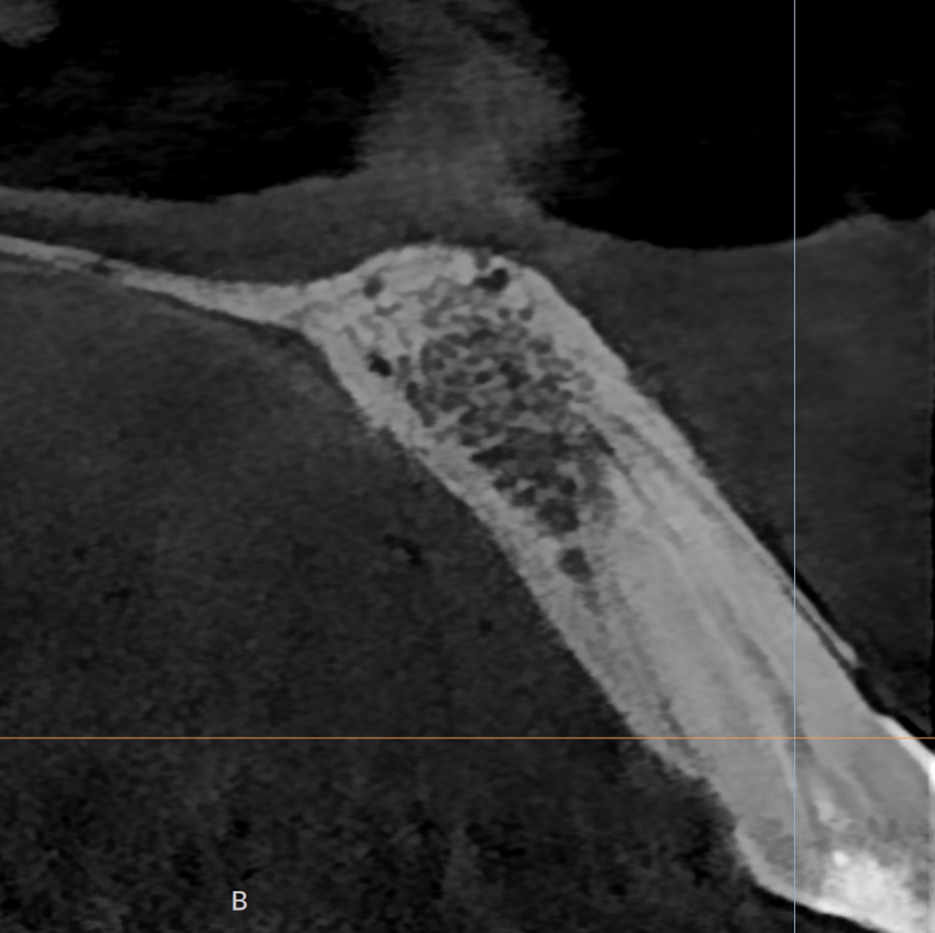 Fig. 1b