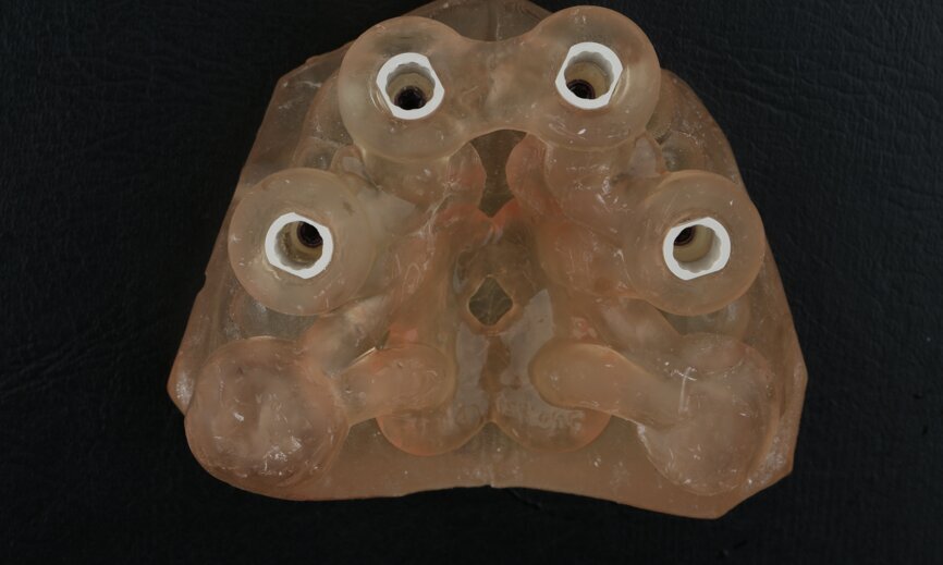 Fig. 22
