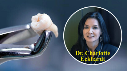 Dental surgeon alarmed by spike in decay-related tooth extractions