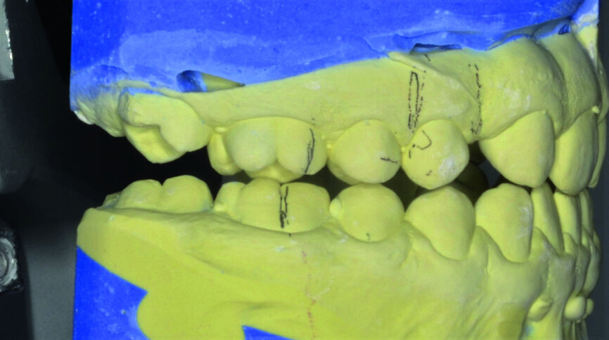Fig. 20