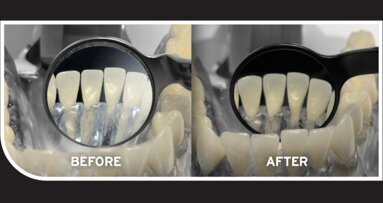 HD BLACK LINE MIRRORS - Proven to Reduce Glare up to 80%*