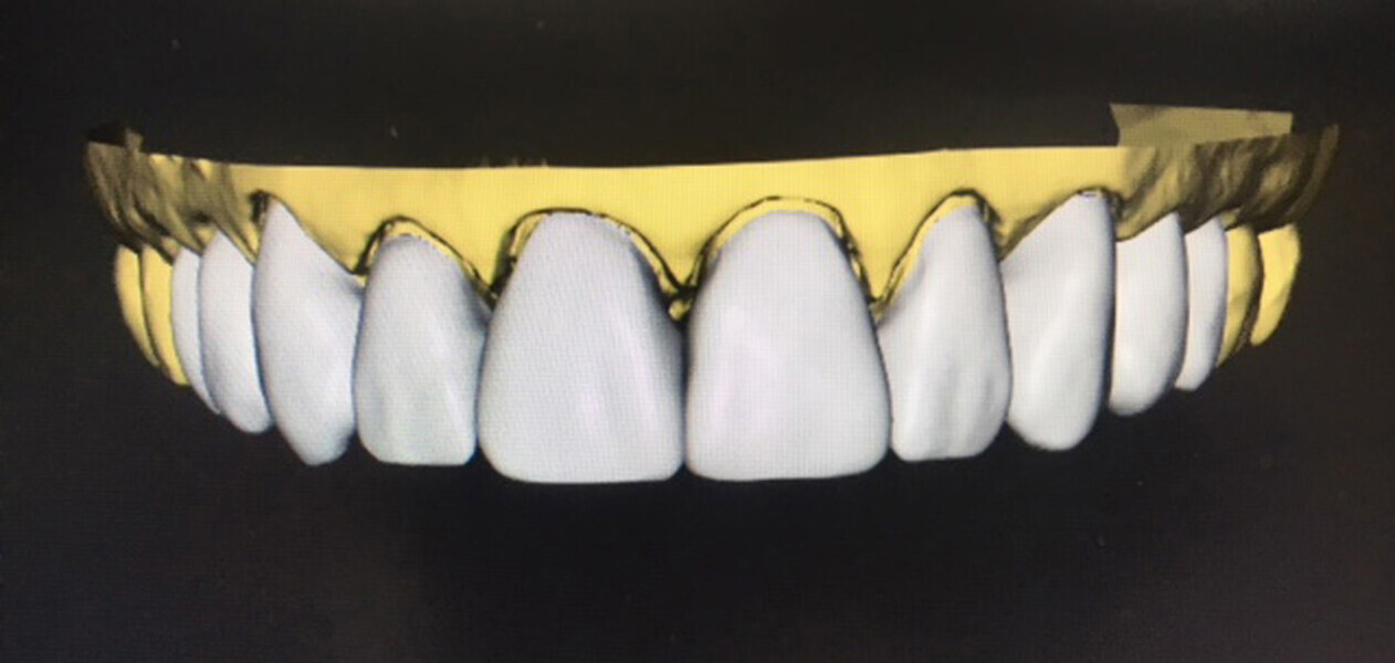 Fig.4