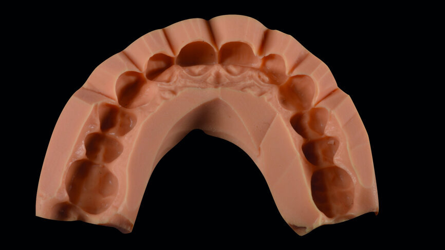 Fig. 8a: Mock-up silicone index.