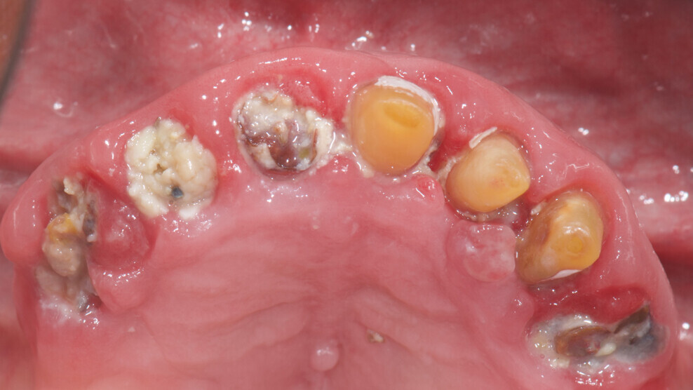 Fig. 2: Initial situation, occlusal view.