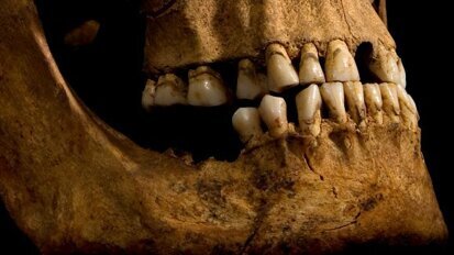 Dentes revelam detalhes do estilo de vida de Ricardo III