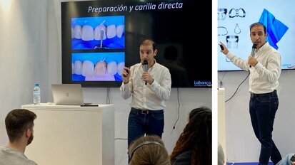 Nuevos protocolos de estratificación con resinas directas