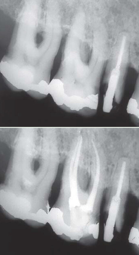 Fig. 11 : Cas clinique Dr Carlos Spironelli.