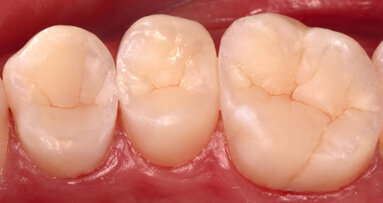 Résultats du Concours international de cas cliniques 2020/2021 de Dentsply Sirona
