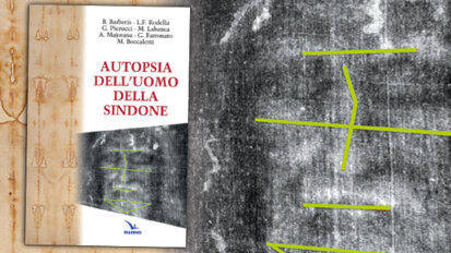 In occasione dell'Ostensione della Sindone, una Autopsia dell’Uomo della Sindone, fatta da 5 medici (tre odontostomatologi)