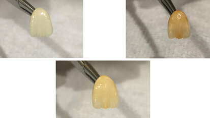 Las tres etapas de los dientes: Inocencia, madurez y sabiduría (2)