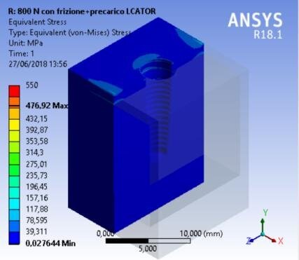 Fig. 11b - Von Mises results, locator prosthesis.