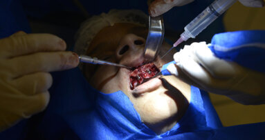 Brazilian dentists offer free dental help to victims of abuse