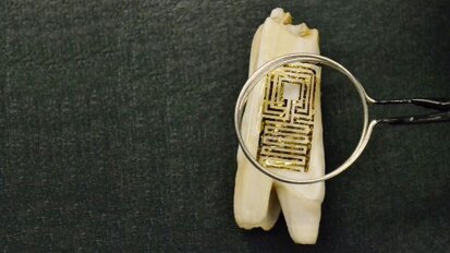 New biosensor on tooth enamel recognizes dental superbugs