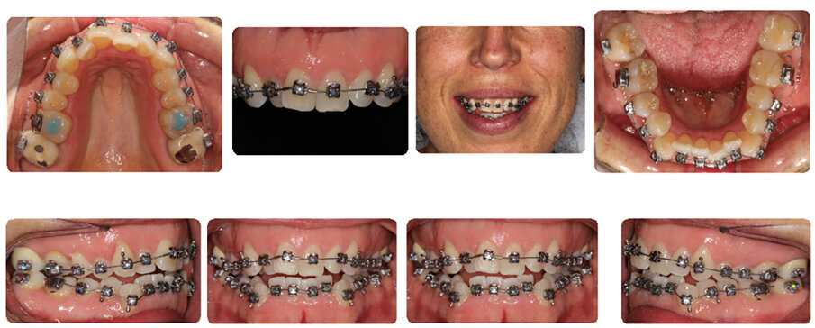Initial treatment