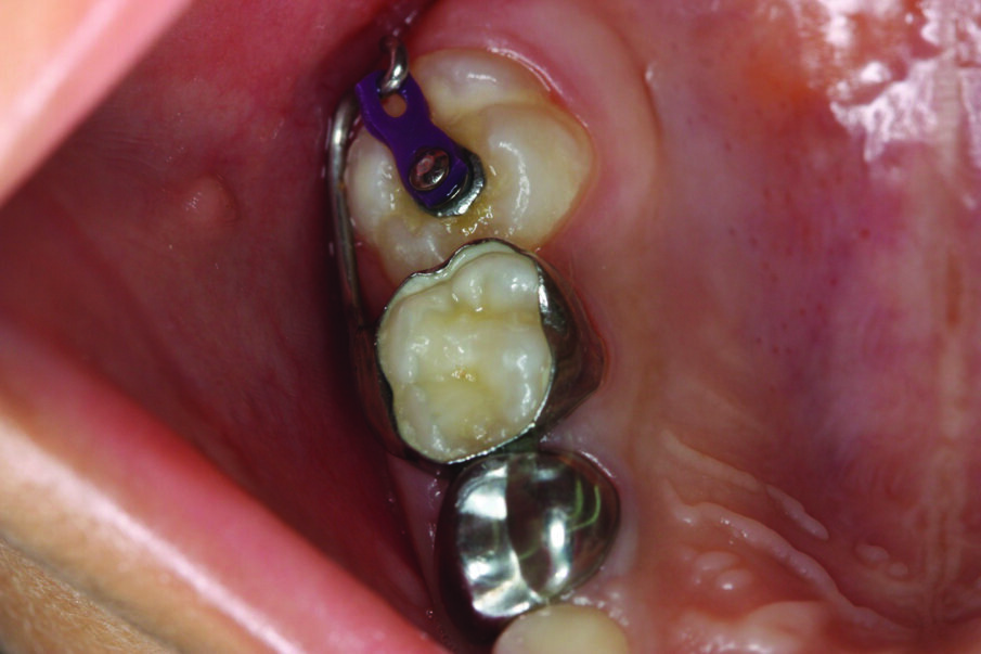 Figure 6b