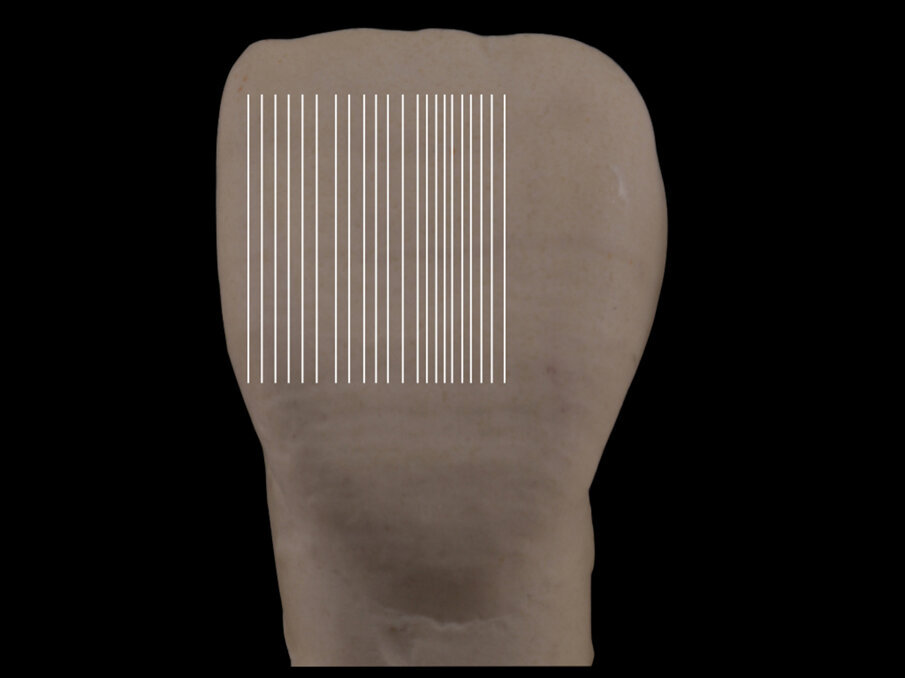 Fig. 6: With long and close vertical lines, the tooth appears longer.
