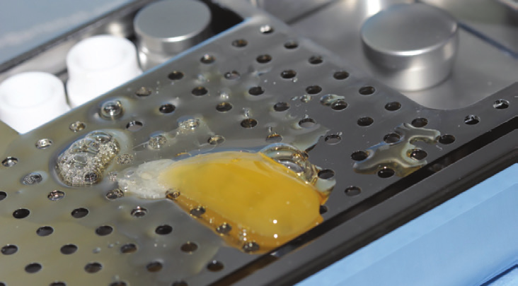 Figure 13: L-PRF withdrawn from tube and placed on tray ready to be converted into membrane.
