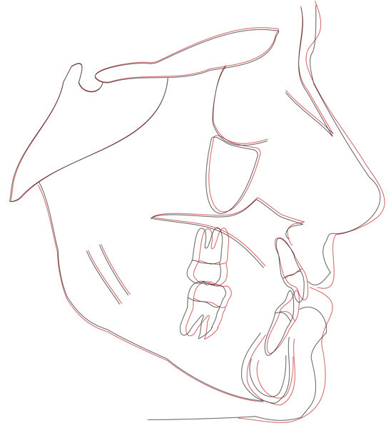 Fig. 46