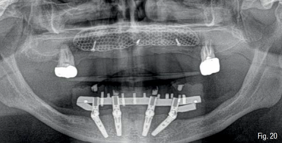 Fig. 20