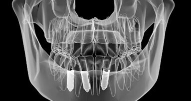 Emersa da una ricerca cinese una certa difformità tra la posizione reale e quella programmata di un impianto