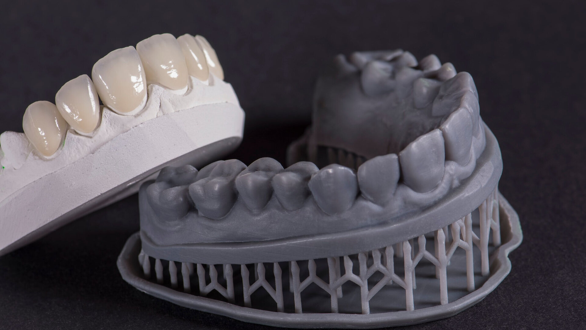 Predictability of the CAD/CAM workflow in today’s aesthetic cases