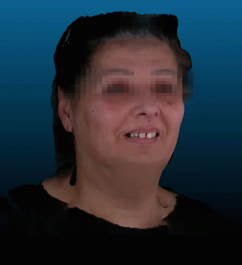 Fig. 4_Scanner facciale 3D.
