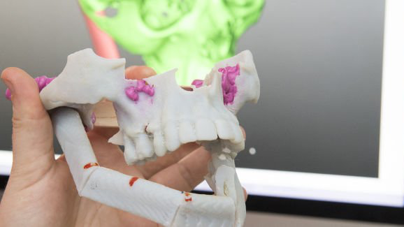 Primer congreso internacional sobre impresión 3-D en medicina
