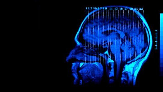 More evidence scanned in CT cancer debate