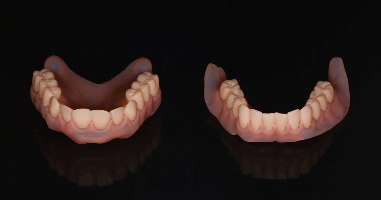 Fig. 7: Checking the fit of the tooth segments in the denture bases.