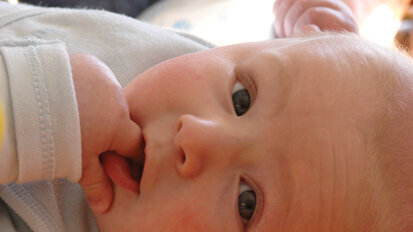 AAOMS seeks insurance coverage for congenital craniofacial anomalies
