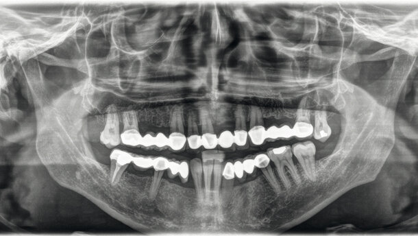 L’odontoiatra può svolgere l’attività radiodiagnostica complementare