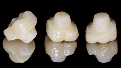 Chairside fabrication of a nano-ceramic hybrid composite endocrown for a severely damaged molar after endodontic treatment