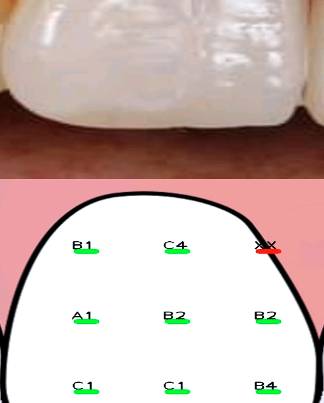 Denthue 6