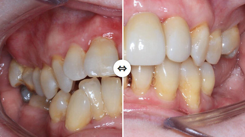 Align Technology announces winner of Invisalign Ortho Summit Case Shoot-Out
