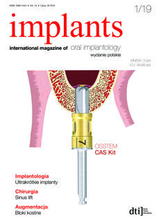 implants Poland No. 1, 2019
