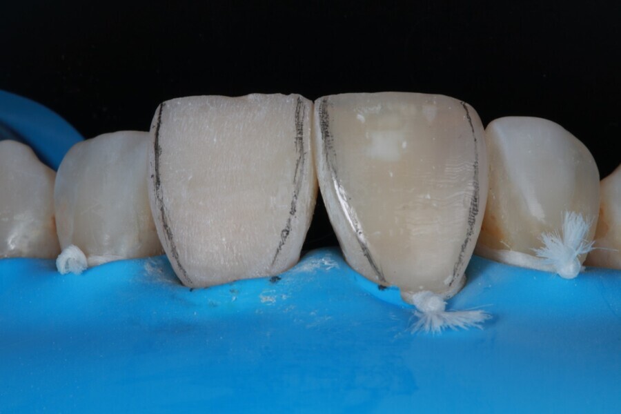 Fig. 5e