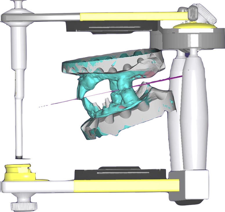 Fig. 14
