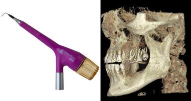 Curso on-line aborda profilaxia e diagnóstico em periodontia