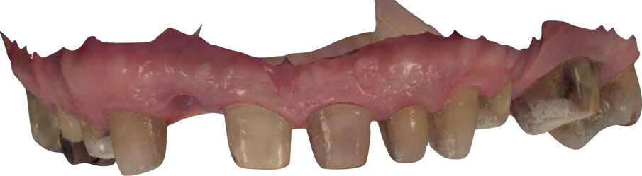 Fig. 12