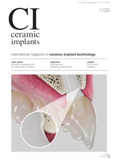 ceramic-implants-international-no-1-2026
