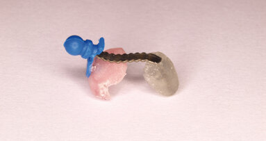 Biomecánica en la técnica CLO3 (Custom-made Lingual Orthodontics in 3 steps – Ortodoncia Lingual Personalizada en 3 pasos)